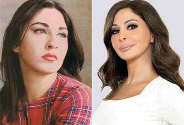 اليسا قبل التجميل - شاهد اليسا قبل وبعد التجميل 5221 2