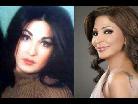 اليسا قبل عمليات التجميل - فنانات قبل التغيير 5703