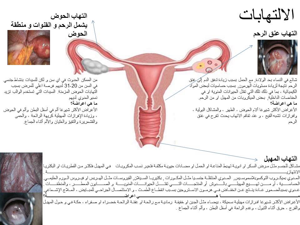 اعراض جرح عنق الرحم - التهابات عنق الرحم واشهر طرق العلاج 6830