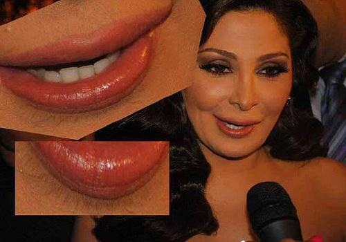 اليسا قبل عمليات التجميل - فنانات قبل التغيير 5703 6