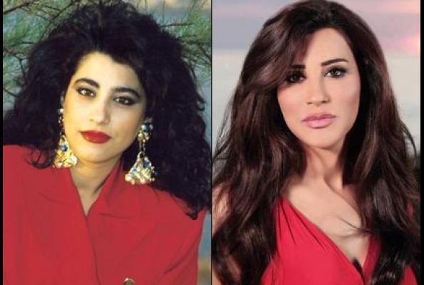 الفنانات قبل وبعد عمليات التجميل - صور للمشاهير قبل تجديد الشكل 5669 3