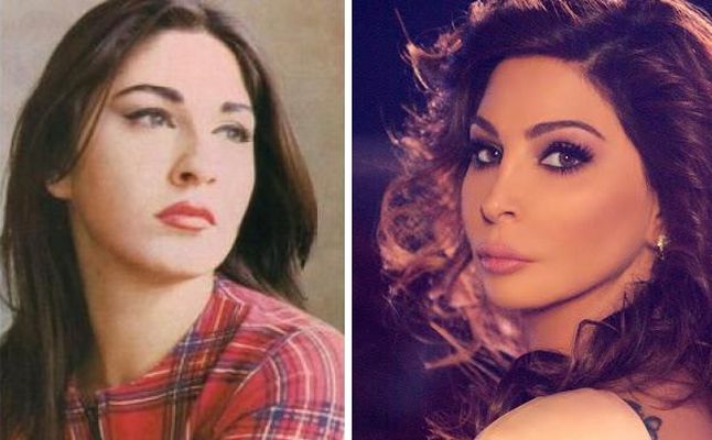 اليسا قبل عمليات التجميل - فنانات قبل التغيير 5703 5