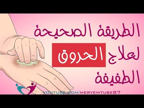 علاج حروق الجسم - وصفة لعلاج الحروق في المنزل 0 157