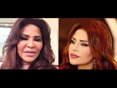 صور احلام قبل التجميل - الفنانه احلام بعد التجميل بالصور 3076 9