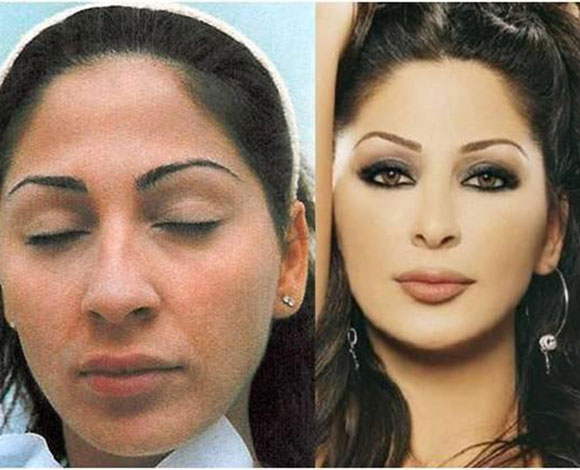 اليسا قبل عمليات التجميل - فنانات قبل التغيير 5703 2