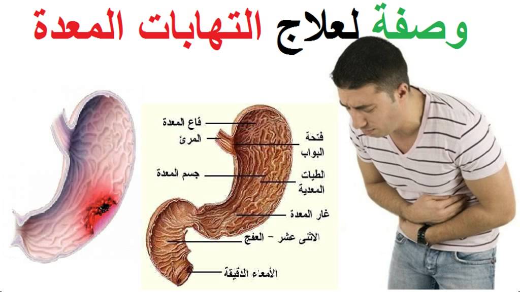 اعراض التهاب فم المعدة , طرق علاج التهاب المعده