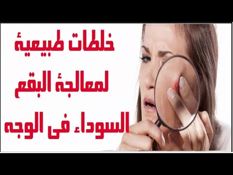 طريقة التخلص من البقع السوداء في الوجه , وصفات لصفاء البشرة