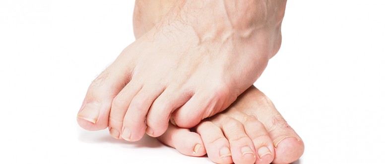 13544 1-Png اذا تورم اصبع القدم نتيجة الحذاء علاج - علاج تورم اصابع الاقدام شوقة غياث